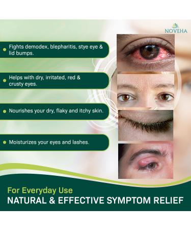 Demodex Eyelid Cleanser Foam | Tea Tree Oil Formula for MGD, Stye & Eye Irritations | Daily Face Wash 3.38 fl oz - Buy Online on GoSupps.com