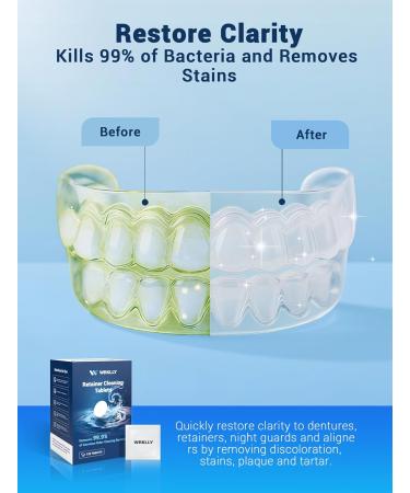Retainer Cleaner Tablets (120 pcs) Denture Cleaning Tablets for Invisalign Night Mouth Guard for Aligners Remove Odors Stains and Plaque Quick Cleanser Mint Fresh Flavor 4 Month Supply Blue - Buy Online on GoSupps.com