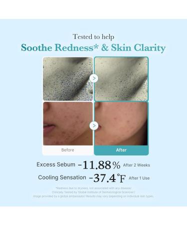 medicube Azelaic Acid Niacinamide Clarifying Toner | Troubled Skin Care Ideal for Purifying & Calming | 4% Azelaic Acid & 2% Niacinamide| Soothing Daily Toner | Korean Skin Care | 8.45 fl.oz - Buy Online on GoSupps.com