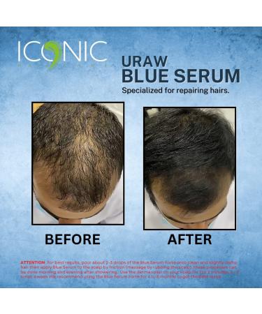 URAW Blue Serum 100ml - Effective Hair Growth & Anti-Hair Loss Serum | New Bottle for International Shipping - Buy Online on GoSupps.com