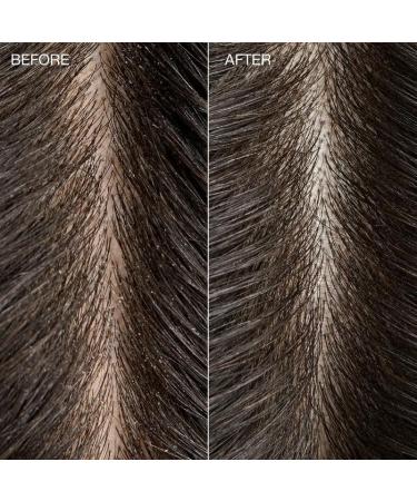 Tea Tree Special Detox Foaming Salt Scrub - Exfoliates & Refreshes Scalp for All Hair Types - 6.5 oz | International Shipping Available - Buy Online on GoSupps.com