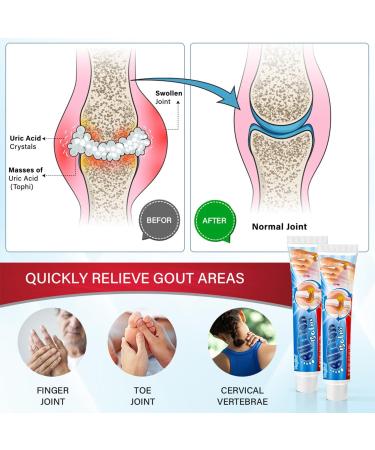 Cr me Apaisante pour les Douleurs Musculaires Cr me Apaisante pour les Oignons Gel de Massage Articulations Professional soin Gel pommades pour l' peron le cou la taille le dos 20g - Buy Online on GoSupps.com
