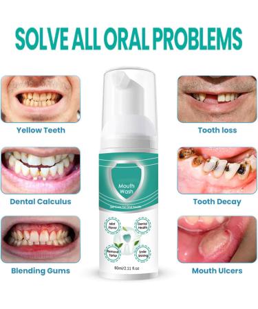 Teeth Mouth Wash Mousse de nettoyage des dents Soin buccal doux et haleine fra che Prot ge les gencives et combat les bact ries Id al pour les d placements et la maison - Buy Online on GoSupps.com