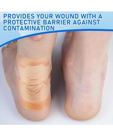 Timgle 10 Pcs Bordered Silicone Adhesive Foam Dressing - High Absorbency Wound Bandages for Heel Elbow Wrist & Foot Care - Beige - Buy Online on GoSupps.com