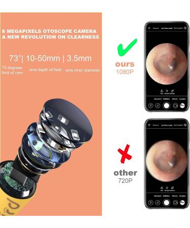 BEBIRD D3 Pro Smart Ear Wax Removal Otoscope Giraffe-Shaped 1080p FHD Wireless Camera | Bendable Lens & Safety Lock | Gentle Ear Cleaner for Kids & Family - Buy Online on GoSupps.com