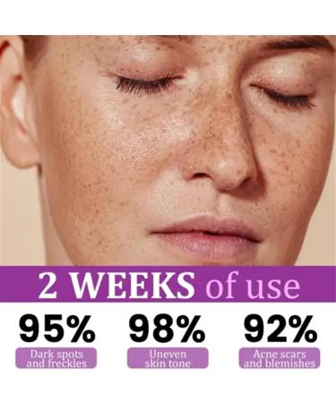  G n rique Anti-Hyperpigmentation Liquid Face Lift Brightening Lifting 30ml for Day and Night Moisturizing Nourishing Solution for Women Girls Feeling Beautiful Sets Visible Results - Buy Online on GoSupps.com