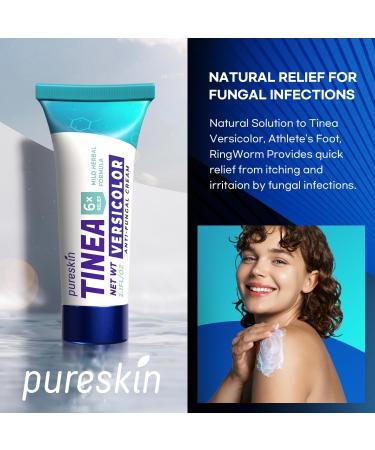 Tinea Versicolor Treatment Cream | Extra Strength Antifungal & Anti-Itch for Ringworm Athlete's Foot & Jock Itch | Natural Formula - Buy Online on GoSupps.com