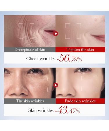 Skin Care Gifts for Women 5 in 1 Snail Collagen Skin Care Kit Includes Gentle Cleanser Toner Cream Serum Lotion Long Lasting Hydration  - Buy Online on GoSupps.com