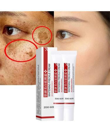 Spot off Freckle Whitening Cream  Dark Spot Corrector Cream  Acne Scar Removal Cream  Effective Moisturizing Acne Spot Treatment Cream  Melasma Melanin Pigmentation Removal Cream for Face (2 Pcs)