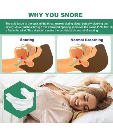 Snoring Guard Stopper - Anti Snore Device for Men | Improve Sleep Quality - Buy Online on GoSupps.com