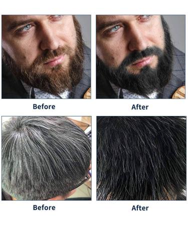 KVSERT 3 x Permanent Beard Dye Shampoo for Dying Beard Removal White Gray Beard Hair Beard Shampoo 200 ml - Buy Online on GoSupps.com