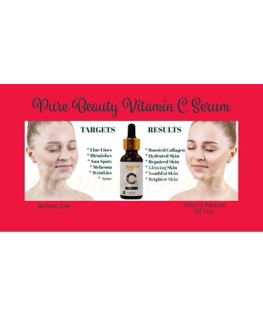 Ammuri Premium Quality Pure Beauty Vitamin C Serum For Anti-Aging power of Vitamin C + E + Amino + Hyaluronic Acid Best for Face Care Skin Care & Skin Glow - Buy Online on GoSupps.com