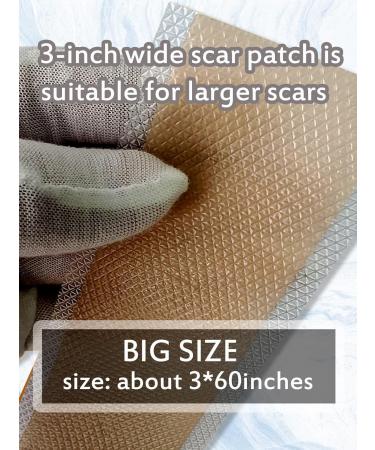 Big Size Silicone Scar Sheets - 3x60'' Roll for Effective Scar Removal | Reusable Silicone Scar Tape for All Types of Scars - Buy Online on GoSupps.com
