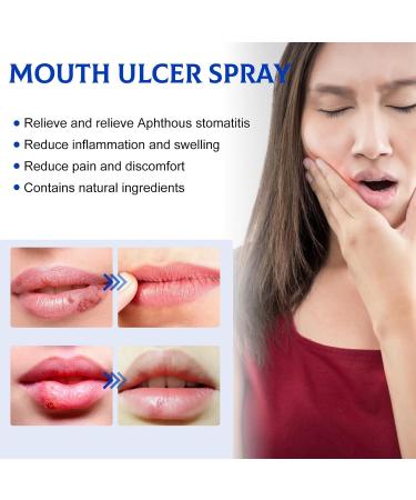 Mouth Ulcer Spray Ulcer Breath Sprays Mouth Ulcer Treatment Spray Ulcer Treatment Canker Sore Treatment Canker Relief Spray Oral Ulcer Sprays Herbal Mouth Spray Dry Mouth Relief Treat Mouth Ulcer - Buy Online on GoSupps.com