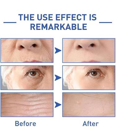 Firming and Smoothing Fine Lines Polypeptide Lifting Eye Cream Natural Moisturizing Eye Cream Can Reduce Puffiness Under-Eye Bags Dark Circles and Wrinkles - Buy Online on GoSupps.com