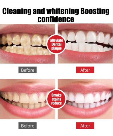 SP7 Probiotic Whitening Toothpaste - Ultra Stain Removal & Deep Cleaning Care for Bright Smiles - Buy Online on GoSupps.com