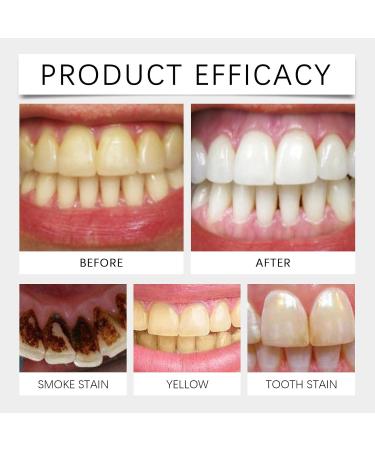 Gentle Clean Toothpaste - Removes Stains Relieves Hot/Cold Sensitivity Daily Care Fresh Breath(1PCS) 1 Fl Oz (Pack of 1) - Buy Online on GoSupps.com