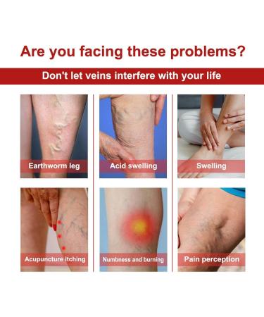 4 & 12 Pieces of Venous Plaster for Varicose & Spider Veins - Improve Blood Circulation & Calm Vasculitis - International Shipping - Buy Online on GoSupps.com