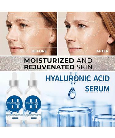Trendyfave Hyaluronic Acid Serum Serums Skincare Moisturiser Face Women For Anti Aging Firming And Plumping Of Skin Fine Lines Deep Wrinkle Filler Brightening Serum Hydrating Serum With Glycerin - Buy Online on GoSupps.com
