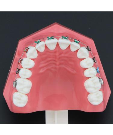 Dental Orthodontic Model with Metal Brackets, Arch Tubes, and Ligature Ties - Standard Size for Teaching and Study - Buy Online on GoSupps.com