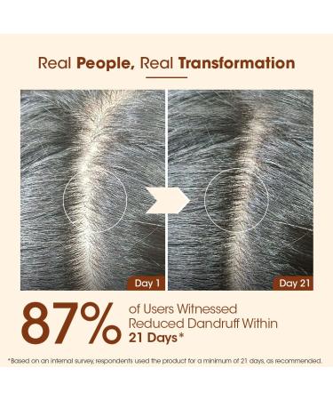 Bhringraj Hair Mask for Hair Growth & Fall Control | 200gm | Nourish Dry & Damaged Hair | For Men & Women - International Shipping - Buy Online on GoSupps.com