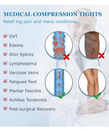 MGANG Medical Compression Pantyhose for Men & Women - 15-20mmHg Support Tights Open Toe Opaque Stockings for Edema & Varicose Veins - Beige Small Size - Buy Online on GoSupps.com