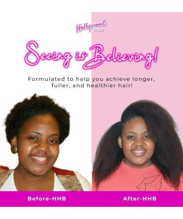 Hollywood Hair Bar Super Grow Scalp Balm - Revitalizing Vegan Scalp Treatment | 4 oz - Cruelty-Free Hair Care for Healthy Growth - Buy Online on GoSupps.com