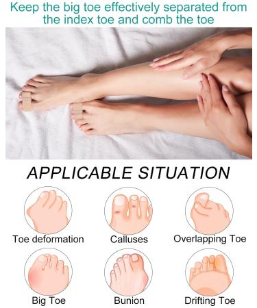 BLATOWN Toe Spacers for Bunion Correction - 2 Pair Set with Elastic Toe Loops and Soft Gel Pads (S+L) - Buy Online on GoSupps.com