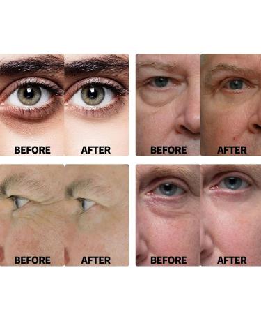 Rosearc Eye Repair Stick for Men Eye Stick Wrinkle Repair Reduces Fine Lines and Bags (2 Pcs) - Buy Online on GoSupps.com