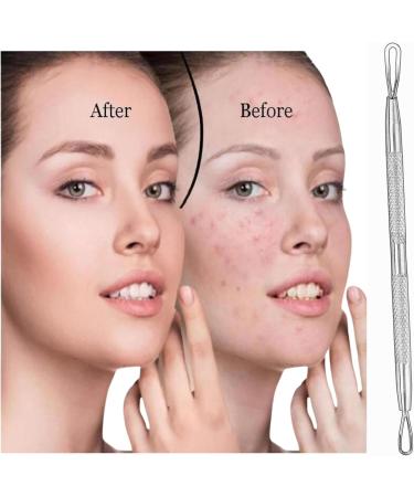 Glamified Blackhead Remover Professional Skincare Spot Treatment Blackhead Remover Tool for Blemish Comedone Whiteheads Pimple Popper with Double Sided Soft Touch and Anti-Slip Design - Buy Online on GoSupps.com