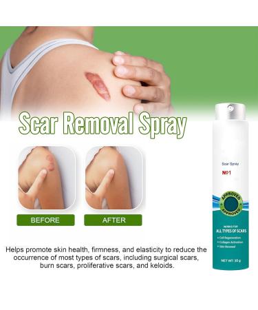 Heal Scar Care Spray | Advanced Formula for All Scar Types | 80g - International Shipping Available - Buy Online on GoSupps.com