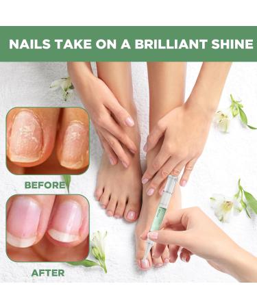 TaimeiMao 3 pieces Nail care with tea tree oil vitamin E and aloe vera for wellgroomed finger and toenails including nail file and cuticle pusher - Buy Online on GoSupps.com