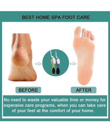 2Pcs Cleaning Pumice Stone 4 in 1 Foot Scrubber with Pumice Stone Sandpaper File Stainless Steel Remove Dead Skin Easily Removing Dead Skin Heels for Both Dry and Wet Feet Foot Care - Buy Online on GoSupps.com