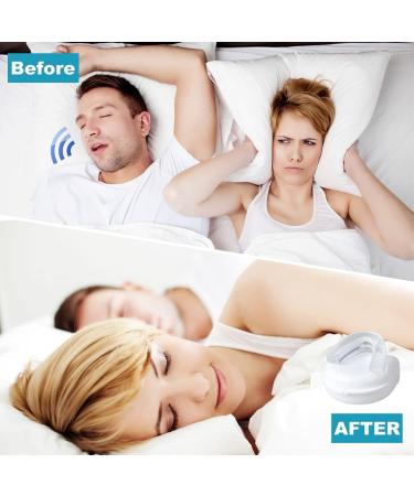 High-Quality Bissing Rails & Anti-Snoring Devices | Night Mouth Guard for Teeth Protection & Bruxism Prevention - Buy Online on GoSupps.com
