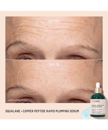 Biossance Instant Hydration Set: Full-Size Squalane + Copper Peptide Serum with Mini Eye Cream & Omega Repair Cream - 1.69 Fl Oz - Buy Online on GoSupps.com
