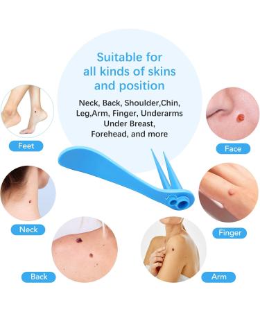 2-IN-1 Micro Skin Tag Tool Kit Quick and Painless Solution for Medium to Large Skin Tags (2mm-7mm) Complete Skin Tag Tool Kit for Fast Results - Buy Online on GoSupps.com