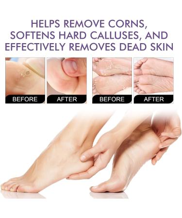 CAOQAO Foot Peel 3 Pack Exfoliator Peel Off Dead Skin Remover 53ML Nail Care Products (Purple One Size) 40 g (Pack of 1) Purple - Buy Online on GoSupps.com