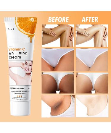 Dark Spot Corrector Cream for Inner Thighs, Legs, Underarms & Knees - Natural Formula - 2pcs - Buy Online on GoSupps.com