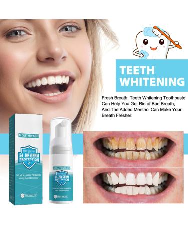 3 Pcs Teeth Whitening & Calculus Removal Foam - Refreshing Breath Dental Care - Buy Online on GoSupps.com