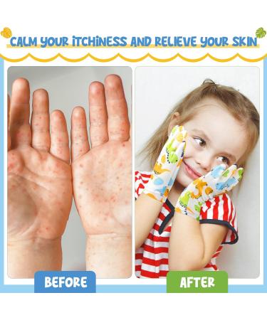 Buy Xtinmee 20 Pairs Eczema Gloves for Kids | Soft Reusable Cotton Moisturizing Gloves for Sensitive Skin (Age 3-4) | International Shipping Available - Buy Online on GoSupps.com