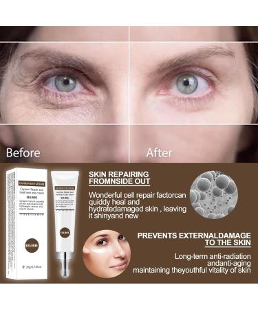 Keptfeet Anti-Aging Eye Cream - Fast Wrinkle Repair for Dark Circles & Swelling | 20g Youthful Skin Treatment - Buy Online on GoSupps.com