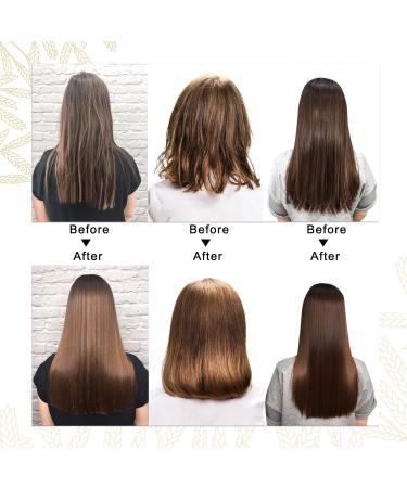 Rice Water Hair Growth Conditioner with Biotin - 10 Fl Oz for Strength Volume & Shine | Softens & Moisturizes Dry Damaged Hair - International Shipping Available - Buy Online on GoSupps.com
