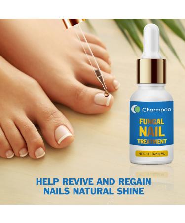Extra Strength Toenail Fungus Treatment - Antifungal Nail Liquid with File and Brush (1fl oz/30ml) - Buy Online on GoSupps.com