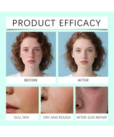 TS TAC-SKY Daily Hydrating Serum - Moisturizes Nourishes Sun-Damaged Skin Reduces Sunburn Discomfort & Boosts Elasticity(1PCS) - Buy Online on GoSupps.com