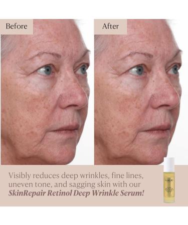 Nakery SkinRepair Retinol Deep Wrinkle Serum (2.02 Fl Oz) Anti Aging Face Serum with Encapsulated Retinol NAD+ Complex Ceramide NP Hydrating Firming Skin Treatment for Fine Lines - Buy Online on GoSupps.com