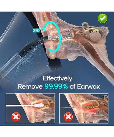 Dotmalls Earclean Pro Outfany Earclean Pro Welnax Electric Ear Cleaner Vianys Ear Clean Pro Electric Ear Cleaner with 4 Water Pressure Modes 6 Reusable Replacement Tips (White) - Buy Online on GoSupps.com