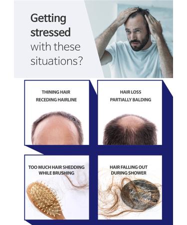 BallVic S Solution - Scalp Care Hair Loss Treatment for Men - DHT Blocker Tonic Serum - 1.8 Oz (50g) - Buy Online on GoSupps.com