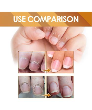  szaluyk Cuticle Removal Gel for Nails | Professional Cuticle Softener | 1oz Instant Gel | Fast-Acting 15s Formula | Moisturizes Damaged Skin | Nail Repair | Nail Care - Buy Online on GoSupps.com