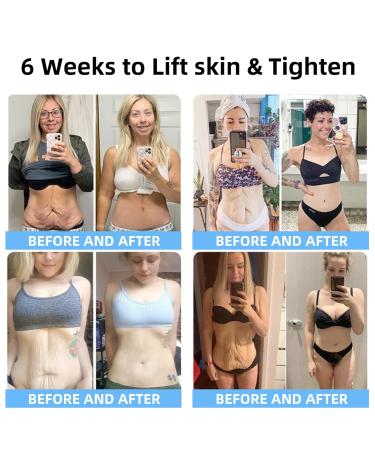 Zoencgz funsta Advanced Firming & Wrinkle-Reducing Cream, Skin firming Rejuvenating Serum, Anti Wrinkle Firming Multi Purpose Cream for All Skin Types, Deep Hydration Barrier (2 Bottle) - Buy Online on GoSupps.com