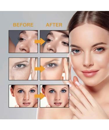 LELEBEAR Japanese Melasma Cream - Skin Care Set for White Spot, Freckles, and Moisturization, Made in Japan by Dr. Hancy - 3PCS - Buy Online on GoSupps.com